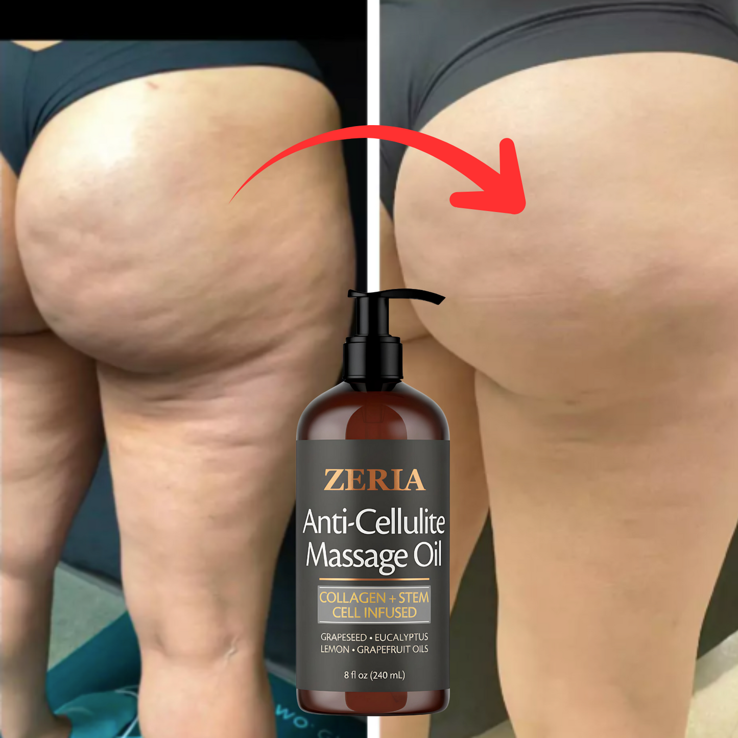 Cellulite Massage Oil.